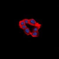 Polyclonal Rabbit anti-Human LPAR1 / LPA1 / EDG2 Antibody (N-Terminus, IF, WB)
