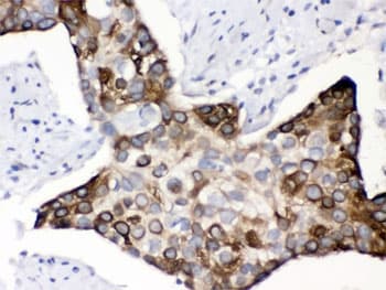 KIN17 / KIN Antibody