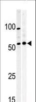 PKMYT1 Antibody (aa452-482)