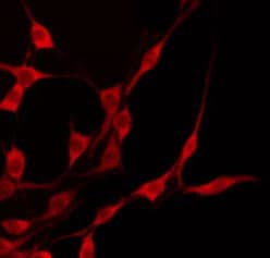 Polyclonal Rabbit anti-Human TRAF3IP3 Antibody (IF, WB)