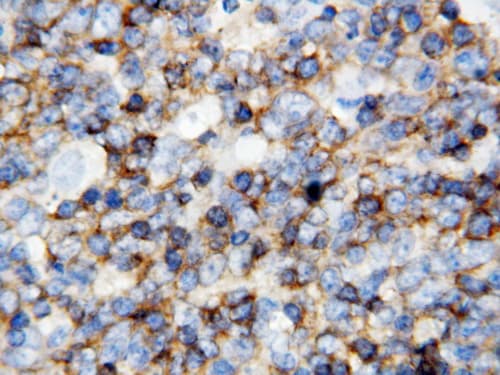 CD45 / LCA Antibody (aa1209-1227)