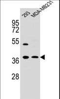 IHC-plus™ ANXA2 / Annexin A2 Antibody (aa19-49)