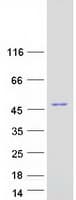 Human NDRG1 Protein (Recombinant Myc-DDK (Flag))