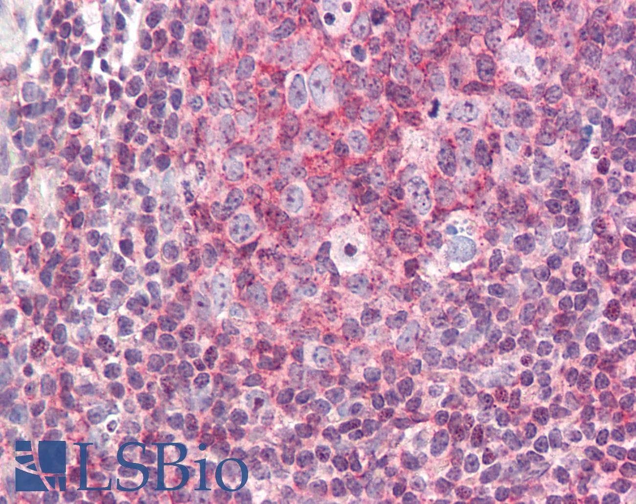 IHC-plus™ PTK2B / PYK2 Antibody (aa369-418)