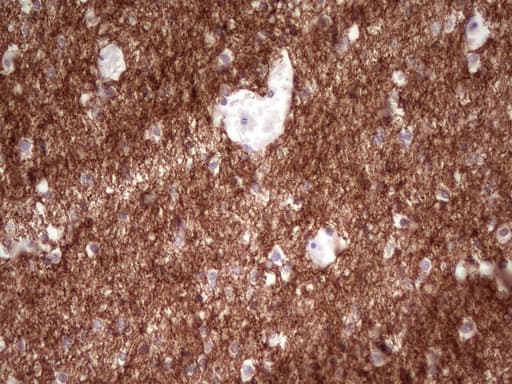 Monoclonal Mouse anti-Human NCAM / CD56 Antibody (clone UMAB192, aa20-718, IHC, WB)