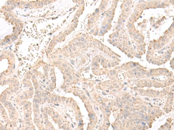ERGIC3 Antibody