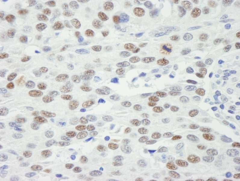 MDC1 Antibody (aa1375-1425)