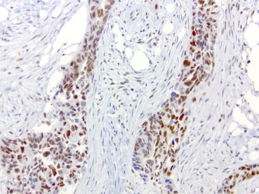ERCC1 Antibody (clone 4F9, Carrier-free)