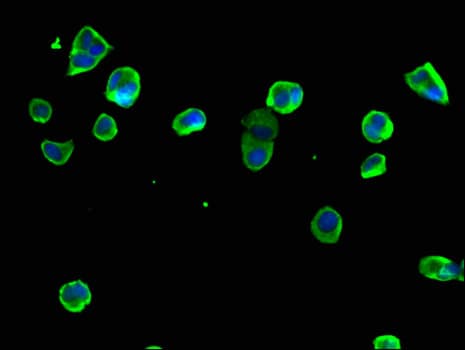 RPS6 / Ribosomal Protein S6 Antibody