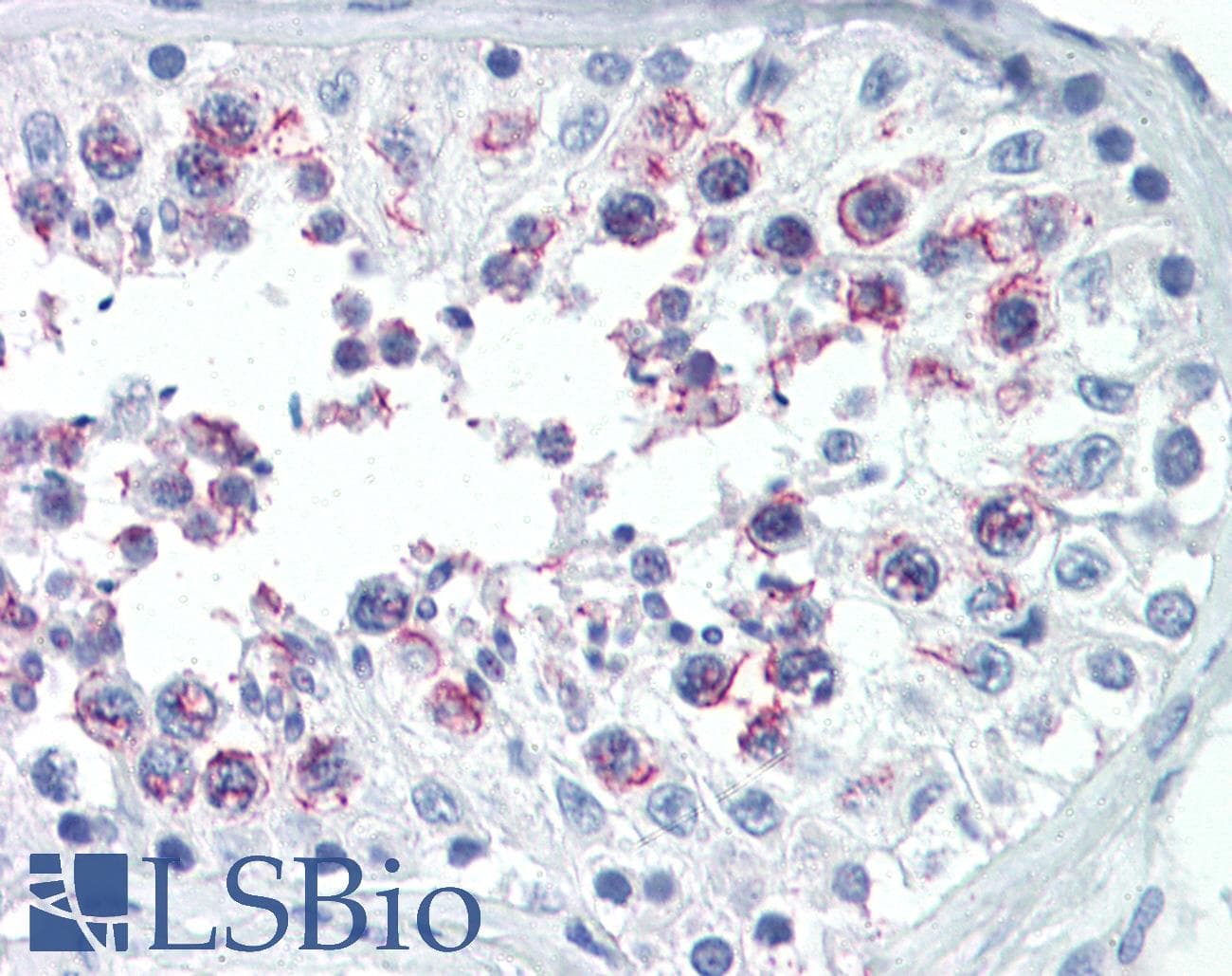 IHC-plus™ SMURF1 Antibody (aa66-96)
