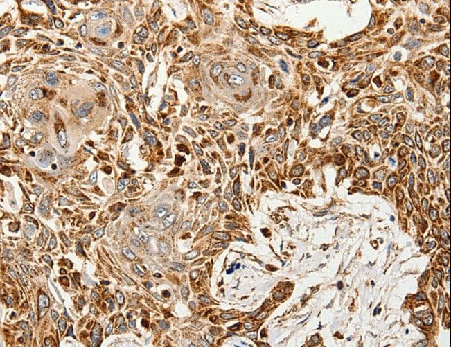 SLC9A7 Antibody