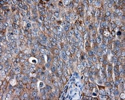 CD36 Antibody (clone OTI6A5)