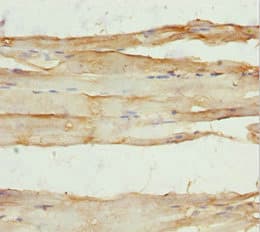 Polyclonal Rabbit anti-Human AK1 / Adenylate Kinase 1 Antibody (IHC, WB)