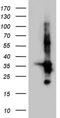 TACC2 Antibody (aa727-1026, clone OTI1C3, Carrier-free)