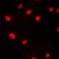 MCM5 Antibody (N-Terminus)