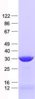 Human ETFA Protein (Recombinant His, N-Terminal)