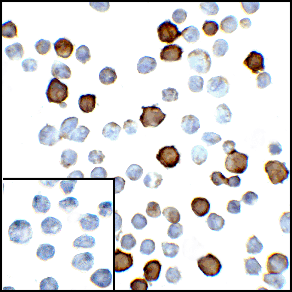 IHC-plus™ PD-L2 / PDCD1LG2 / CD273 Antibody (clone 8C12)