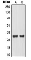MLX / TCFL4 Antibody (Internal)