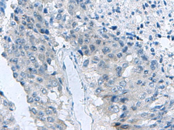 MED31 Antibody
