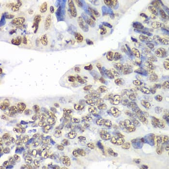 Polyclonal Rabbit anti-Human NONO / P54NRB Antibody (IHC, IF, WB)