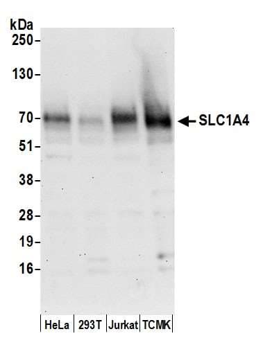 SLC1A4 / ASCT1 Antibody (aa482-532)