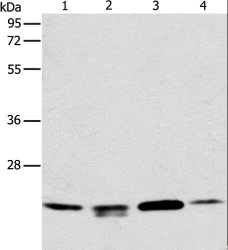Polyclonal Rabbit anti-Human PRDX2 / Peroxiredoxin 2 Antibody (IHC, WB)