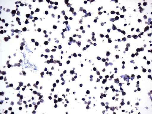 MME / CD10 Antibody (aa411-750, clone UMAB235)