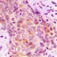 C-TAK1 / MARK3 Antibody (N-Terminus)