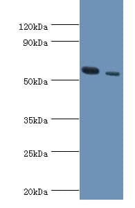 IHC-plus™ Polyclonal Rabbit anti-Human RNF8 Antibody (aa1-260, IHC, WB)