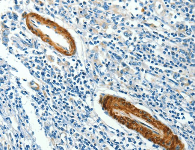 CAV3 / Caveolin 3 Antibody
