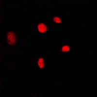 Polyclonal Rabbit anti-Human MYBL2 Antibody (C-Terminus, IF, WB)