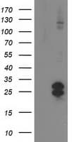 FGF21 Antibody (aa29-209, clone OTI2F8)