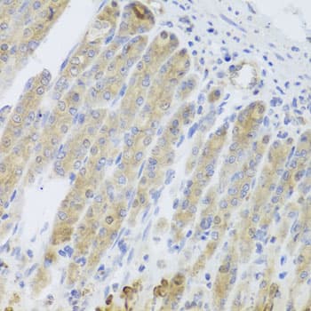 RARS2 / ARGRS Antibody