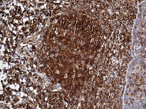SPTAN1 / Alpha Fodrin Antibody (aa1-147, clone OTI9C10)