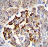 GAD65 Antibody (aa109-138)