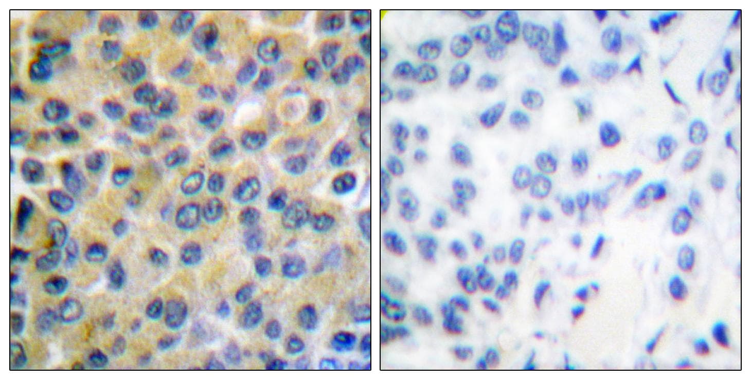 PTPN11 / SHP-2 / NS1 Antibody (p580)
