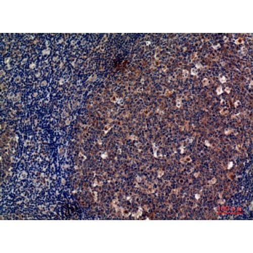 ANPEP / CD13 Antibody (881-930 aa, C-terminal)