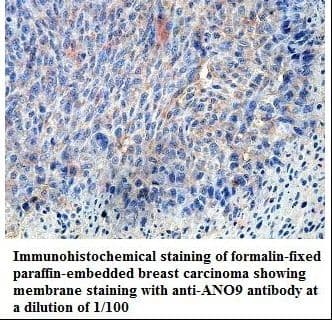 Polyclonal Rabbit anti-Human ANO9 / TMEM16J Antibody (aa81-224, IHC, WB)