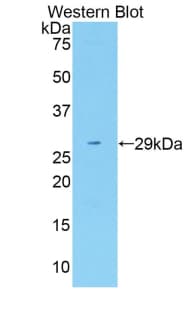 FASN / Fatty Acid Synthase Antibody (aa2257-2504, Biotin)