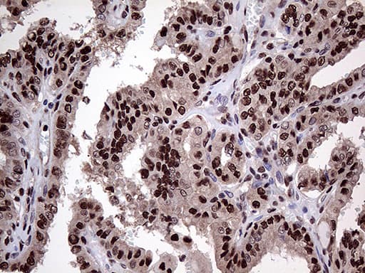 PPP4C Antibody (clone OTI2E4)