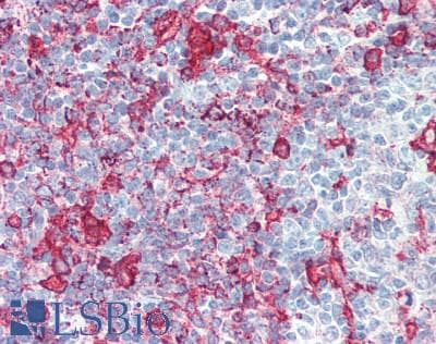 IHC-plus™ Polyclonal Rabbit anti-Human CYBA / p22phox Antibody (IHC, IF)