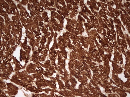 TNNT2 / CTNT Antibody (clone OTI7D2)