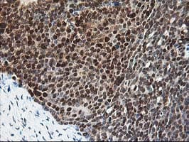 PDXK / PNK Antibody (clone OTI5H5)