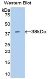 KRT15 / CK15 / Cytokeratin 15 Antibody (aa105-411)