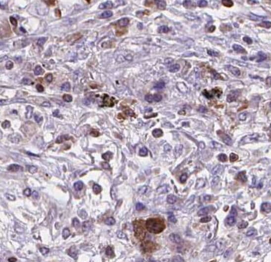 BNIPL Antibody