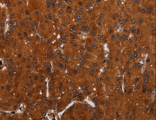 Polyclonal Rabbit anti-Human NOX3 Antibody (IHC)