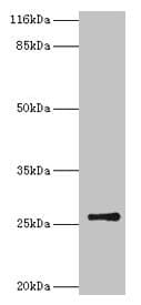 TK1 / TK / Thymidine Kinase Antibody (aa2-234)