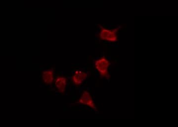 ARRB1 / Beta Arrestin 1 Antibody