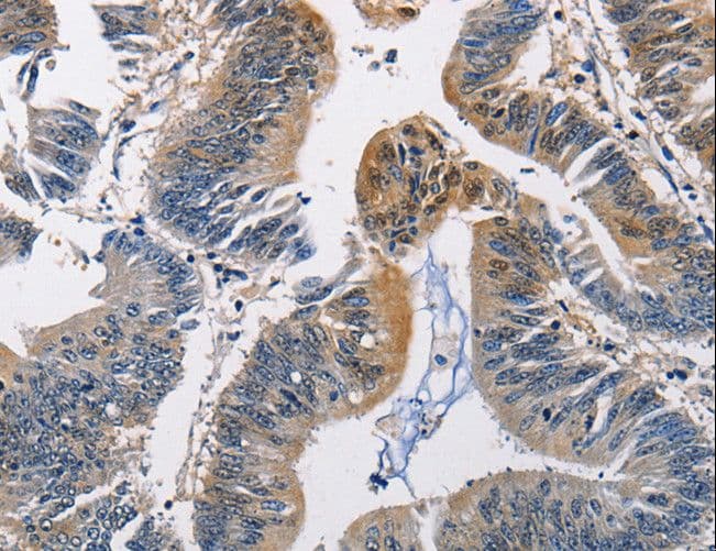 PGK1 / Phosphoglycerate Kinase Antibody