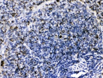 Polyclonal Rabbit anti-Human GC1qR / C1QBP Antibody (IHC, WB)